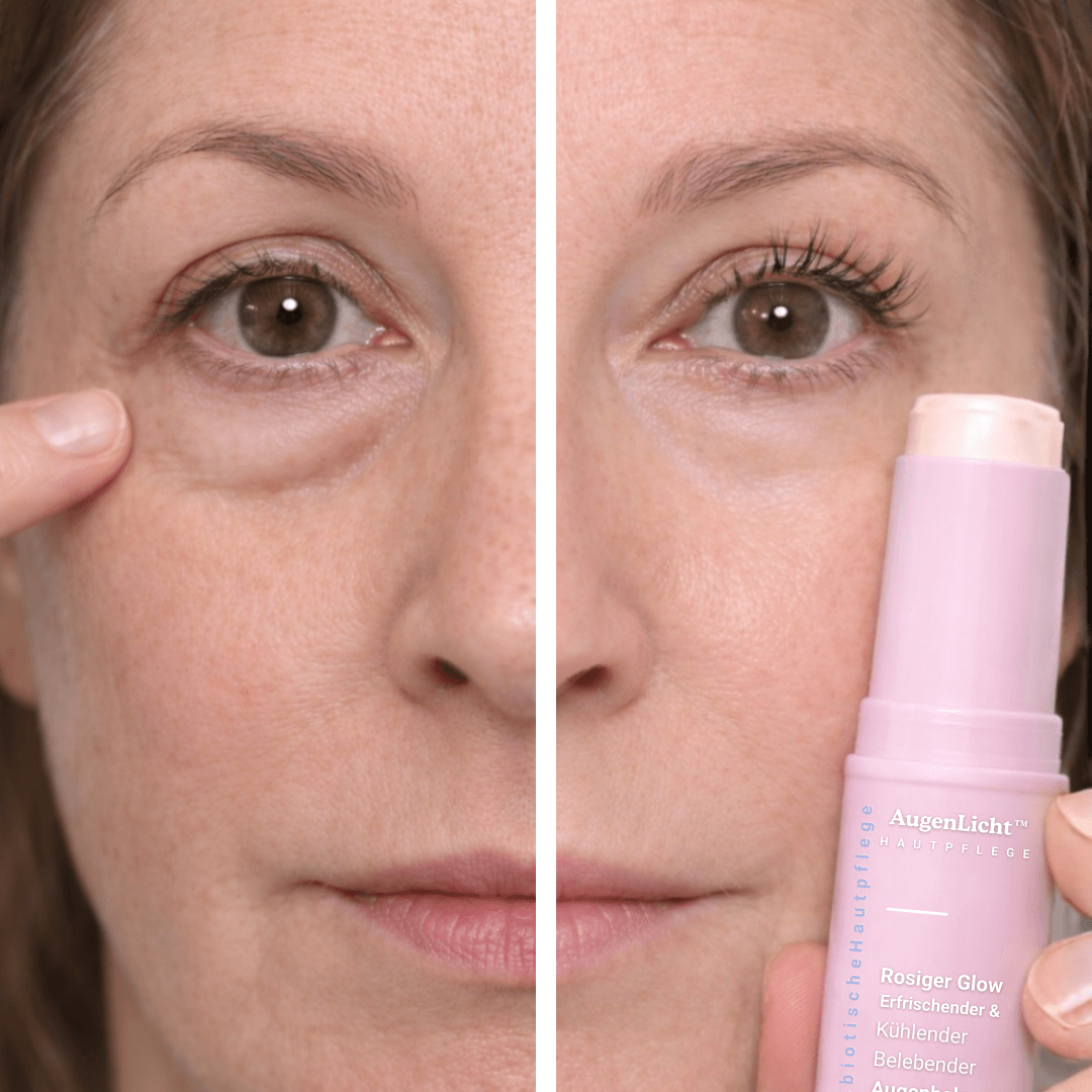 AugenLicht™ Augenbalsam